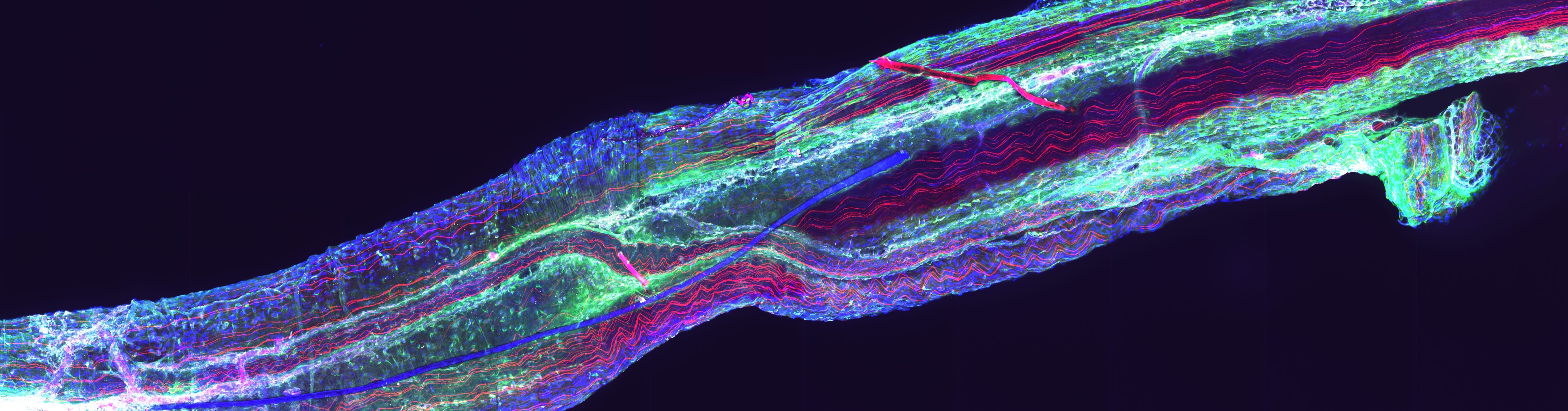 Fluorescence imaging of a sciatic nerve in the Hong Lab